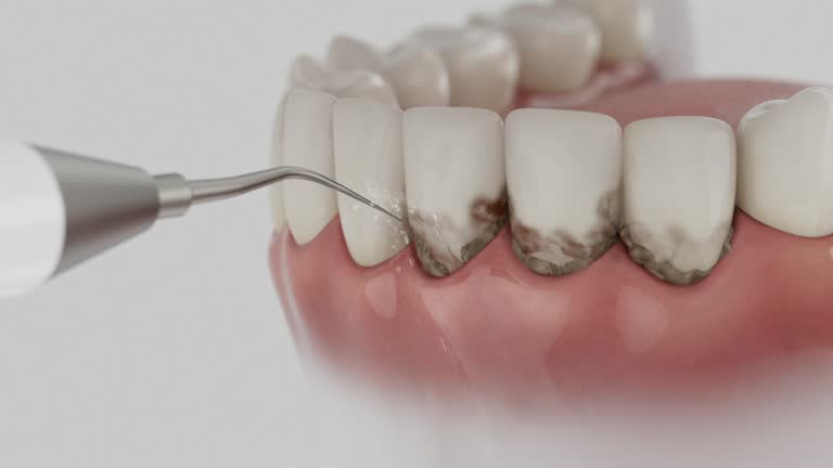 Trusted Teeth Cleaning And Checkup service in Flowery Branch, GA - Dentist Open Now
